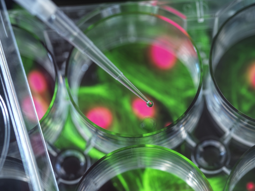 Alzheimer’s Disease (AD) Model: Tau Phosphorylation Assay Cell Line
